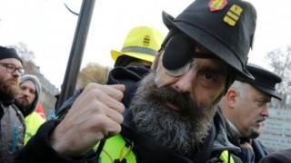 Родригес с черной повязкой на лице