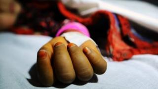 ریپ کا نشاشنہ بننے والی بچی کا ہاتھ