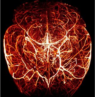 The network of blood vessels in the brain of a mouse
