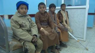 Trẻ em Yemen trong một bệnh viện tại Marib