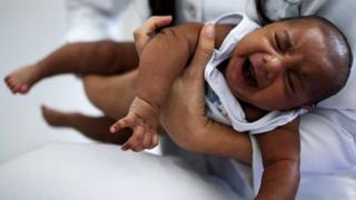 சுகப்பிரசவ குழந்தைகள் மட்டும்தான் நோய் எதிர்ப்பு தன்மையுடன் இருக்குமா?