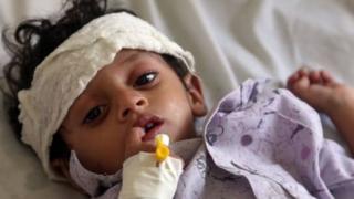 Yemen