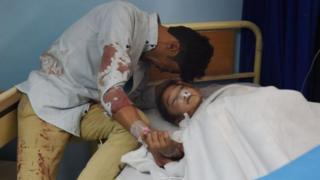 Zahra, une fille âgée de huit ans, fait partie des blessés de l'attentat.