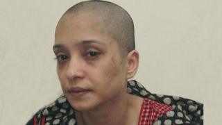 Asma Aziz careca com hematomas no rosto