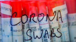 Мазки от пациентов с коронавирусом COVID-19 хранятся в пластиковой запечатанной ванне, пока лаборанты проводят диагностический тест на коронавирус в микробиологической лаборатории в специализированном вирусологическом центре университетской больницы Уэльса в Кардиффе