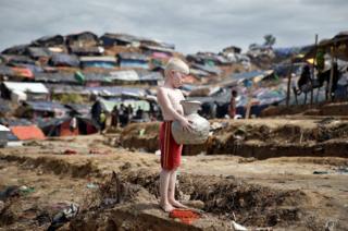 Un niño rohingya albino carga un jarro con agua en un campo de refugiados.