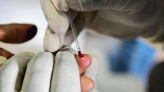 Environ 37 millions de personnes dans le monde vivent avec le VIH ou le sida. Et il y a environ 1,8 million de nouveaux cas chaque année.