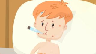 Cartoon boy with measles