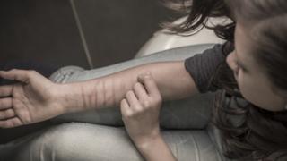 scarred girl