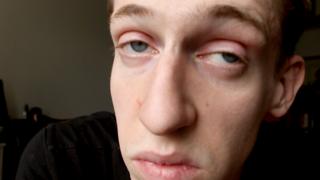 Elliot Murawski after taking heroin