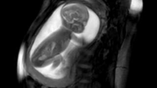 Imaging of embryos