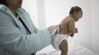 E se as brasileiras, com medo da zika parassem de engravidar?