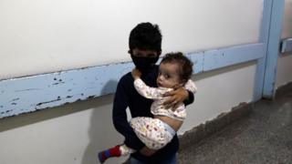 Bir bebek Yemen'in başkenti Sanaa'daki Sabeen hastanesinde sınırlı tedavi görür,