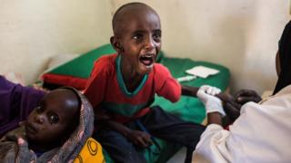 El pequeño Abdullahi Mohamud llora al recibir una inyección.