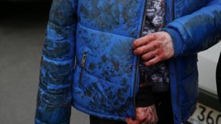 Пострадавший у метро "Сенная площадь"