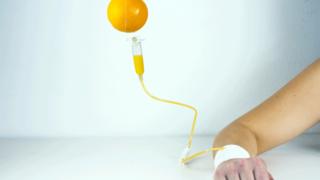 Un goteo intrevenoso de jugo de naranja