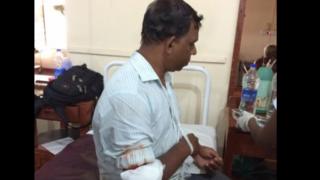 'චුන්නාකම්හිදී පොලිසියේ දෙදෙනකුට ප්රහාරයක්'