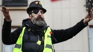 Ативист Жером Родригес обратился к протестующим через неделю после того, как получил ранение в глаз