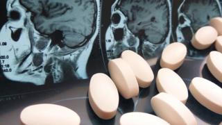 Radiografía y medicinas
