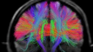 Brain signals weaken when some cells wear out