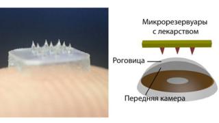 Схема применения