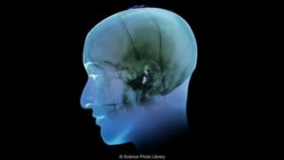 Imagen del cerebro.