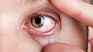 ojo