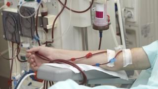 Dialysis ga dhèanamh
