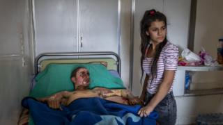 Injured Kurdish Fighter Receives Hospital Visit