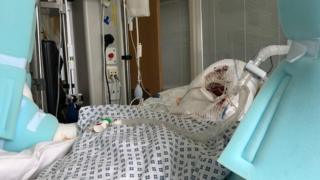 Крис Уильямс-Эллис находится в искусственной коме в больнице