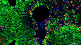Transplanted cells
