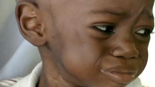 Unicef say di moni no reach to treat all di pikin dem