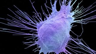 Prostate cancer cell