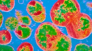 A micrograph of the bacteria that causes gonorrhoea