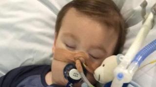Alfie Evans con un ventilador pulmonar. Foto: cortesía página de Facebook de Alfie's Army.