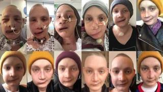 Collage de fotos el proceso de reconstrucción facial de Jen Taylor en un año.