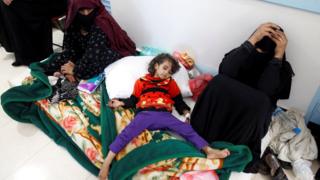 Yemen'de koleradan etkilenen bir kız