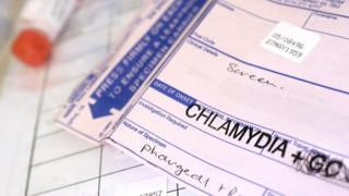 Sexually transmitted infection test