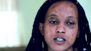 Model With Scars