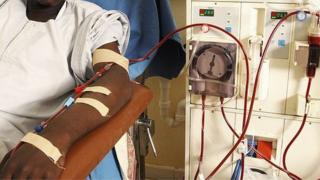 Pesin dey do im hemodialysis