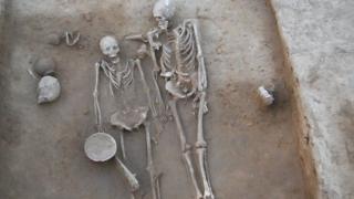 skeleti para