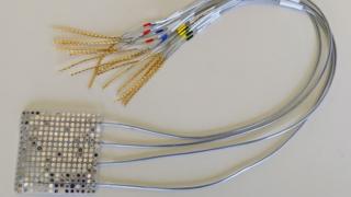 ‘Exhilarating’ implant turns thoughts to speech