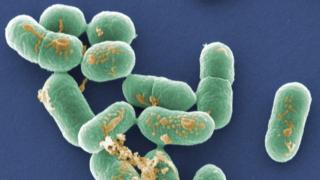 Цветная сканирующая электронная микрофотография (СЭМ) бактерий Listeria monocytogenes