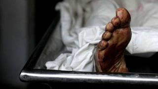 Leg for morgue