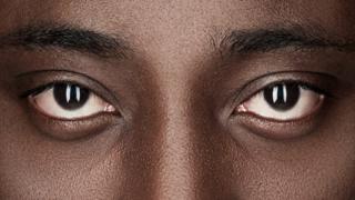 Ojos de un hombre afrodescendiente.
