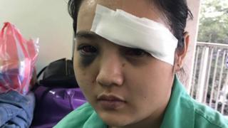 Victim of a violent attack