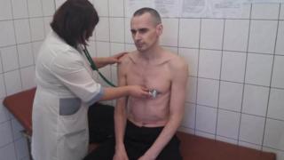 Олег Сенцов в больнице