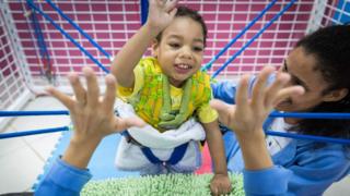 niños zika
