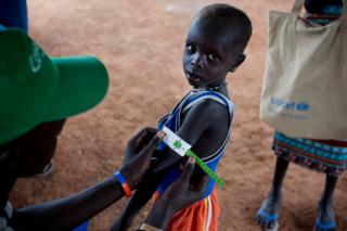 Güney Sudan'da açlık çeken çocuk