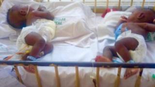 Ejima gbakọrọ ọnụ